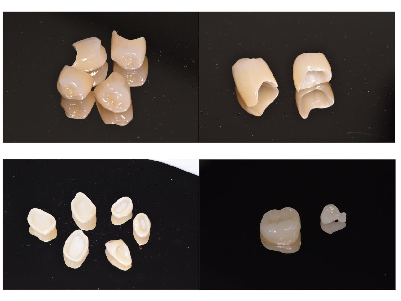 あかなべ歯科_セラミック治療_1