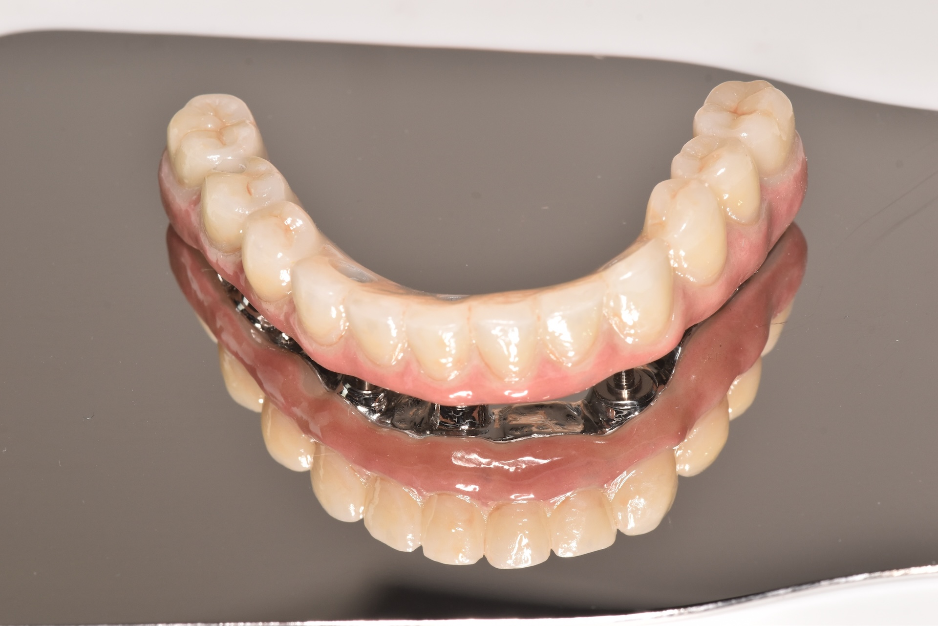 あかなべ歯科_インプラント_オールオン4